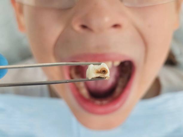 Best Broken or Cracked Tooth Emergency Dentist in Ingalls Park, IL