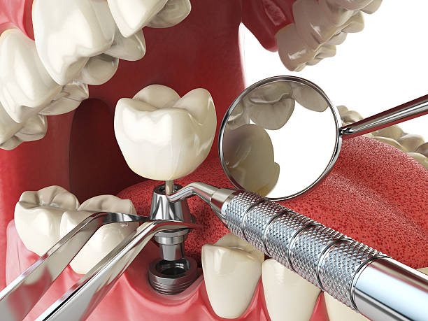 Best Emergency Dentist for Knocked-Out Tooth in Ingalls Park, IL